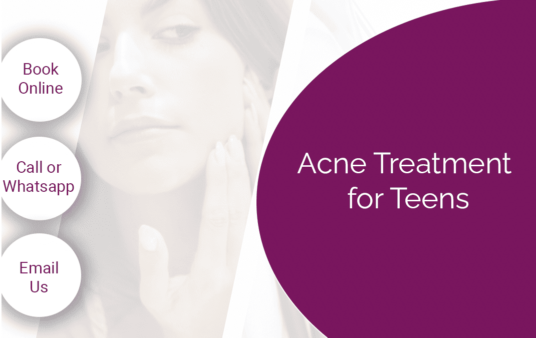 acne treatment for teens