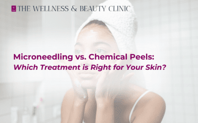 Microneedling vs. Chemical Peels: Which Treatment is Right for Your Skin?