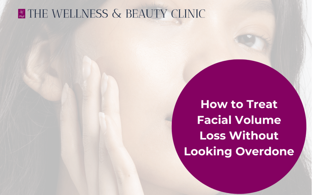 facial volume loss blog