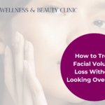 facial volume loss blog