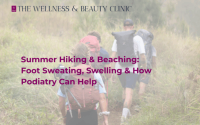 Summer Hiking & Beaching: Foot Sweating, Swelling & How Podiatry Can Help