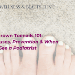 Ingrown Toenails