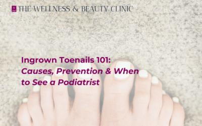 Ingrown Toenails 101: Causes, Prevention & When to See a Podiatrist