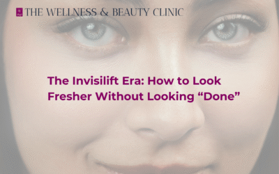 The Invisilift Era: How to Look Fresher Without Looking “Done”