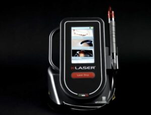 laser treatment