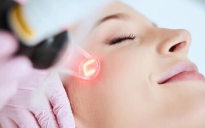 Laser Treatment in West Hamstead.