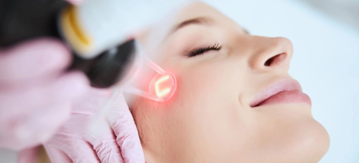 laser treatment
