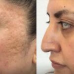 Worthing laser and skin clinic