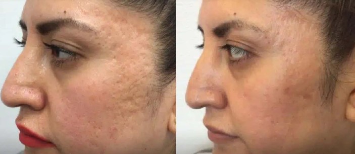 Worthing laser and skin clinic