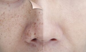 worthing laser and skin clinic